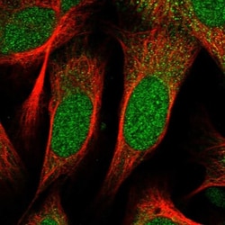 ZNF518B Antibody, Novus Biologicals 25 &mu;L; Unlabeled:Antibodies, Polyclonal